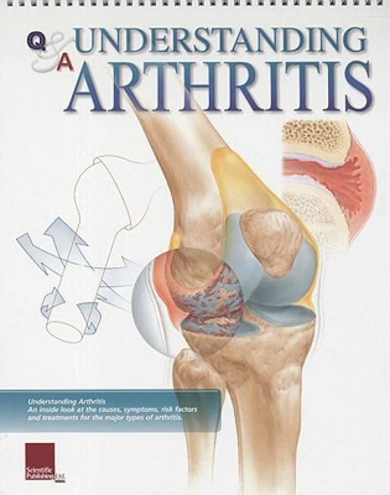 Understanding Arthritis Flip Chart