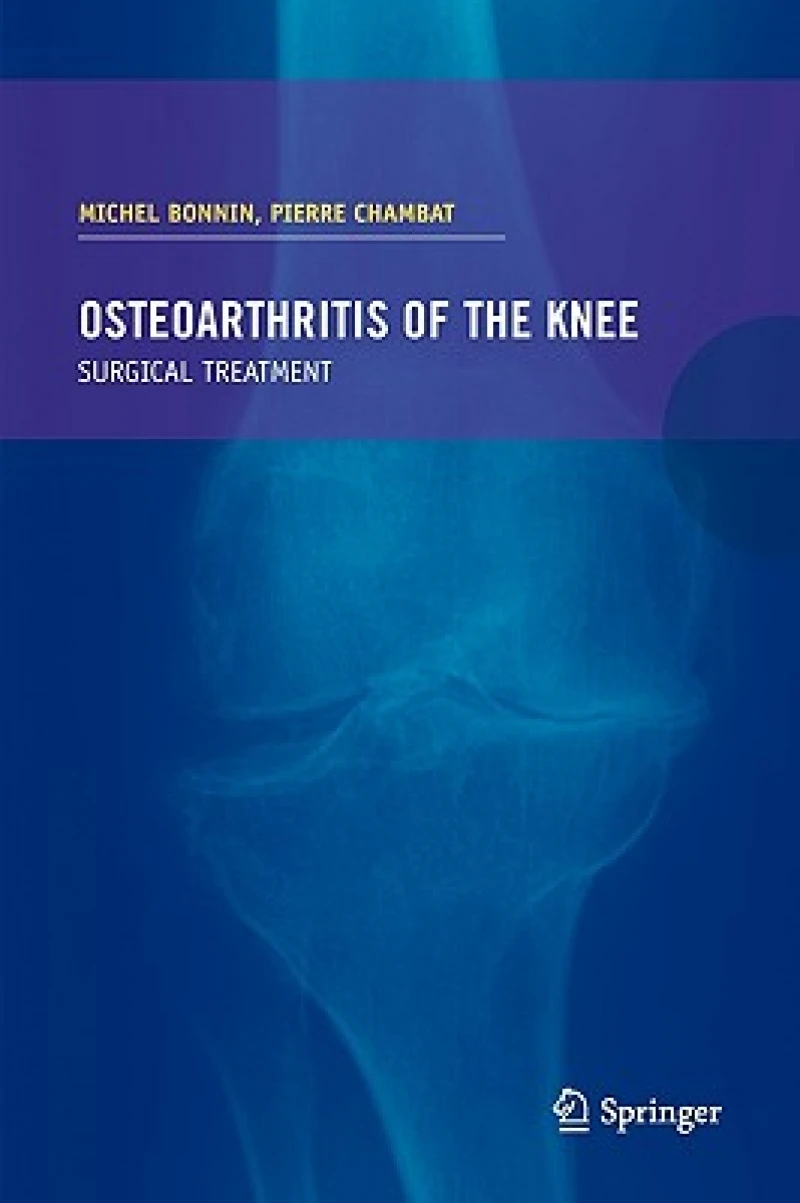 Osteoarthritis of the knee