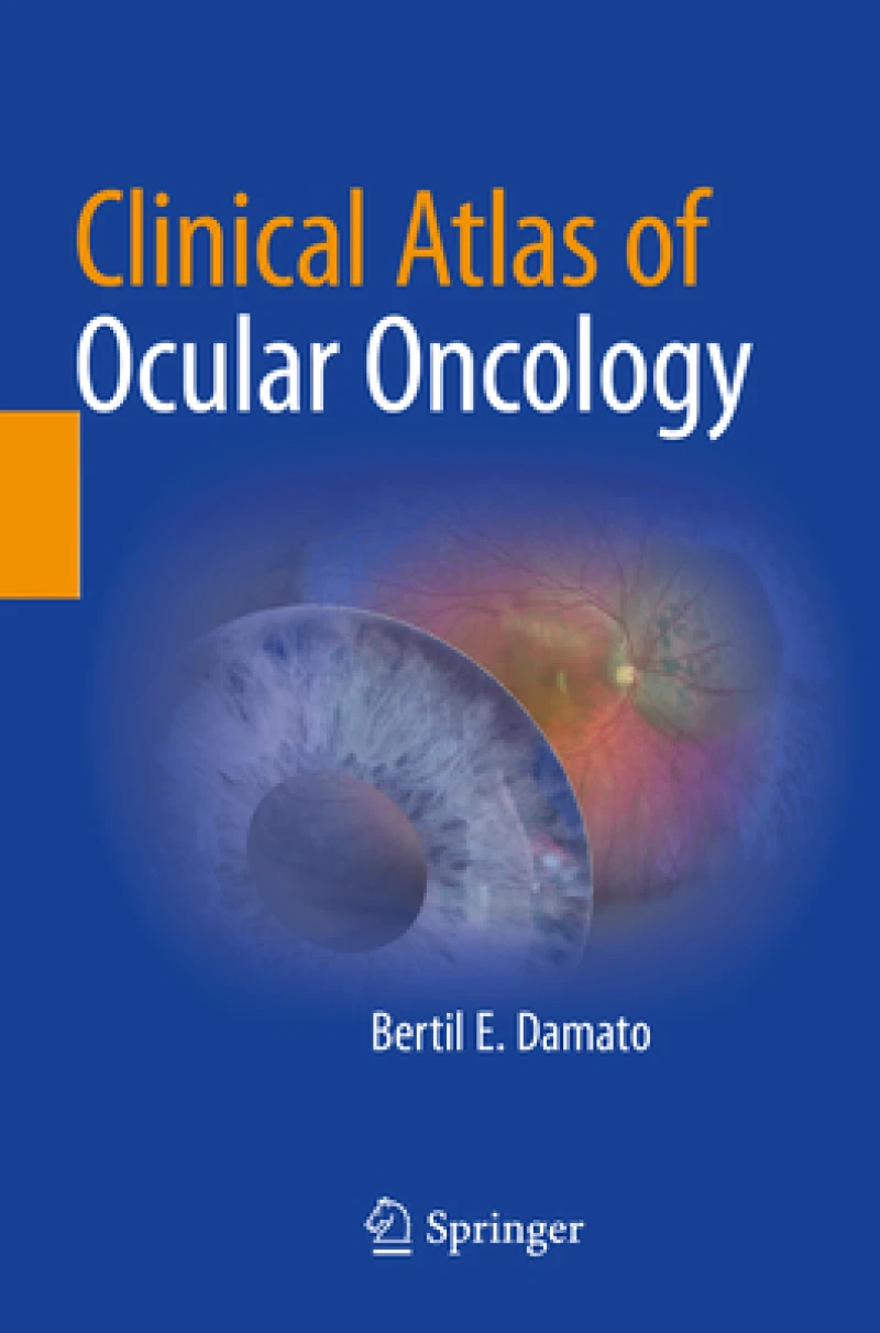 Clinical Atlas of Ocular Oncology