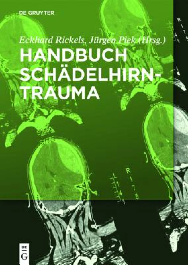Handbuch Schädelhirntrauma