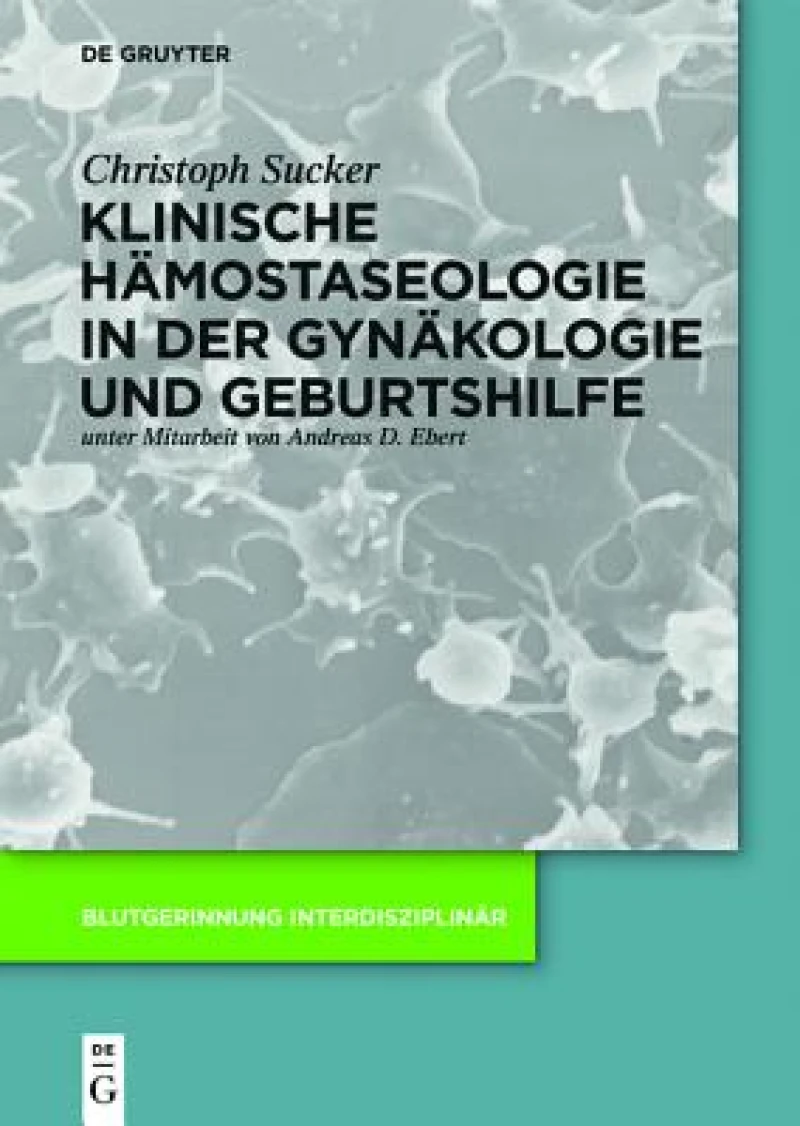 Klinische Hämostaseologie in Der Gynäkologie Und Geburtshilfe