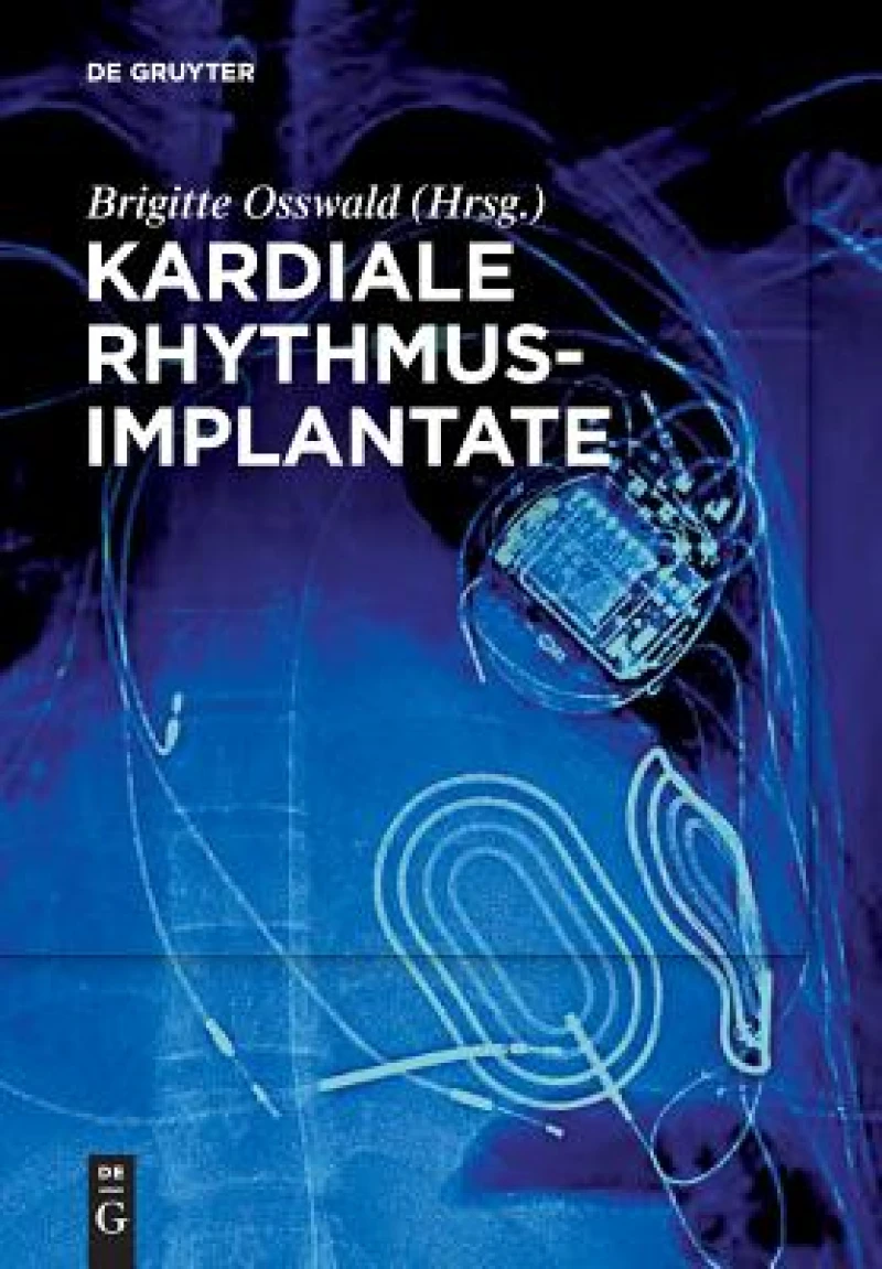 Kardiale Rhythmusimplantate