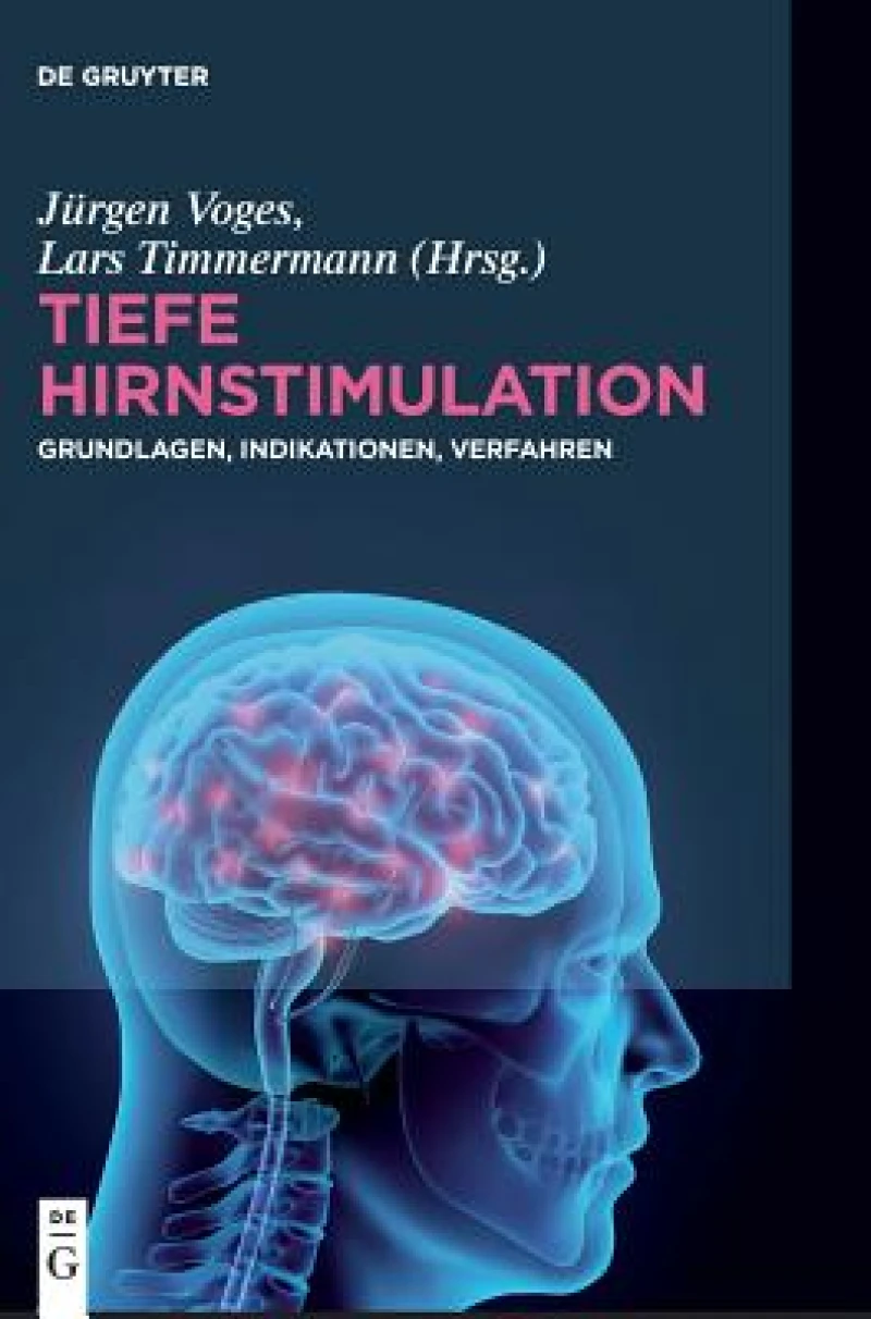 Tiefe Hirnstimulation