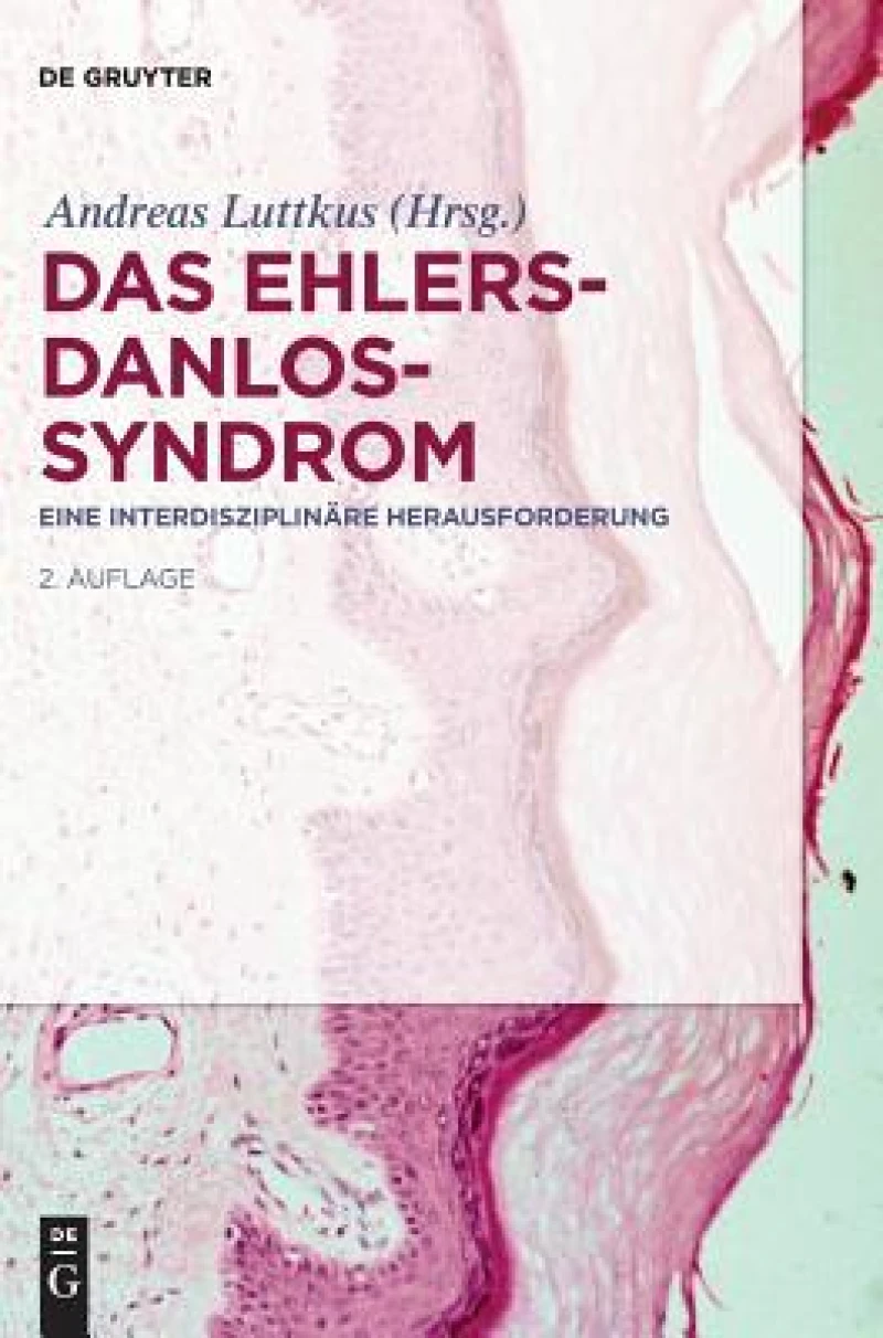 Ehlers-Danlos-Syndrom