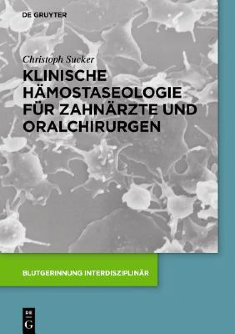Klinische Hämostaseologie Für Zahnärzte Und Oralchirurgen