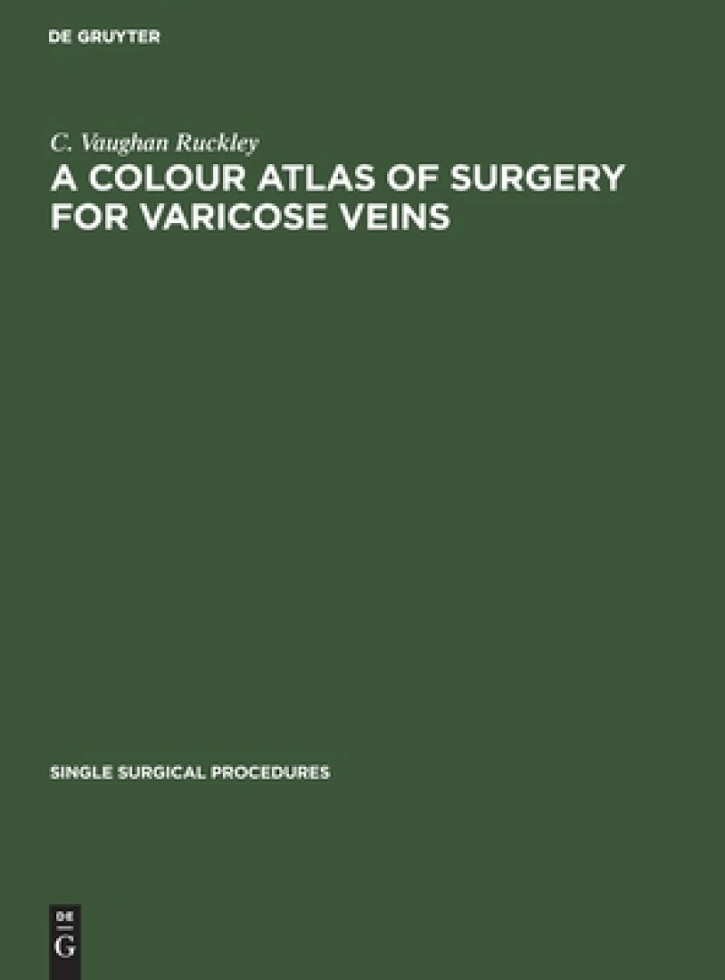 Colour Atlas of Surgery for Varicose Veins