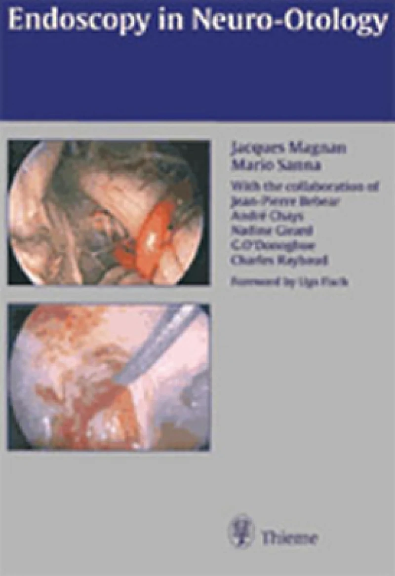 Endoscopy in Neuro-Otology and Skull Base Surgery (at)