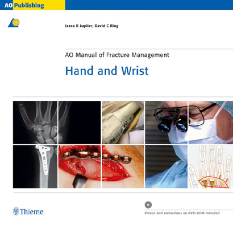 AO Manual of Fracture Management - Hand and Wrist