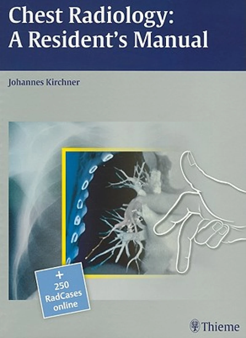 Chest Radiology: a Resident's Manual