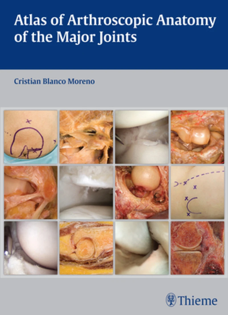 Atlas of Arthroscopic Anatomy of the Major Joints