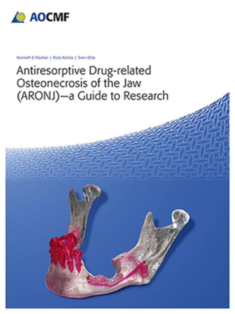 Antiresorptive Drug-Related Osteonecrosis of the Jaw (ARONJ) - a Guide to Research