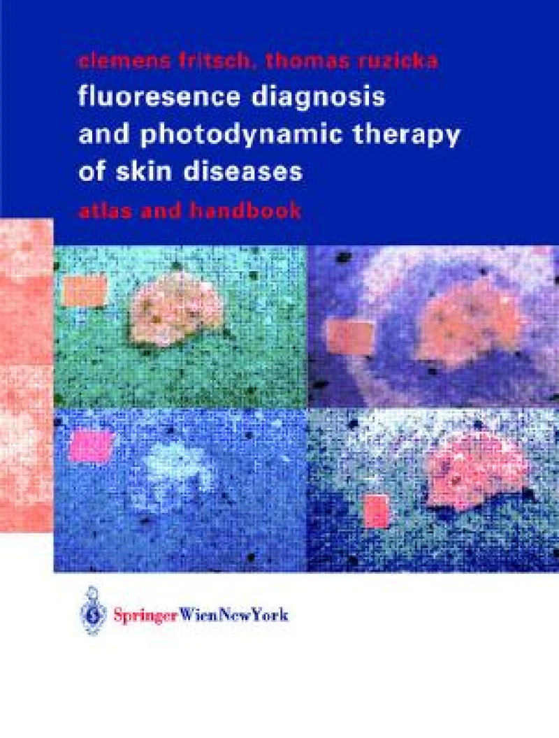 Fluorescence Diagnosis and Photodynamic Therapy of Skin Diseases