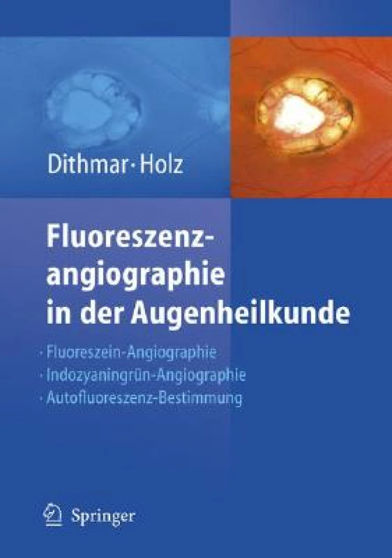 Fluoreszenzangiographie in der Augenheilkunde