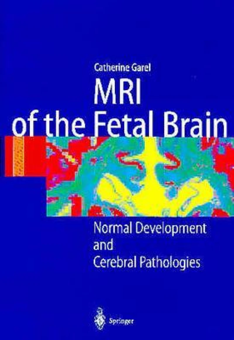 MRI of the Fetal Brain