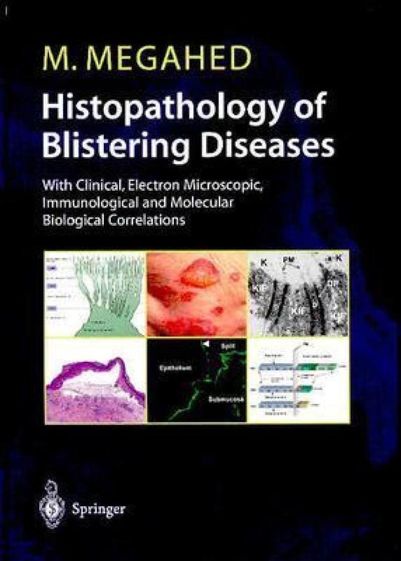 Histopathology of Blistering Diseases