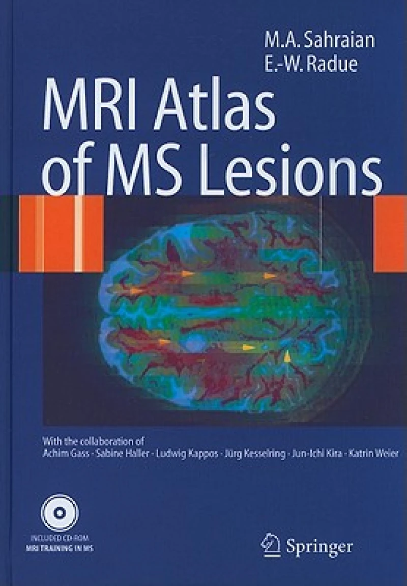 MRI Atlas of MS Lesions