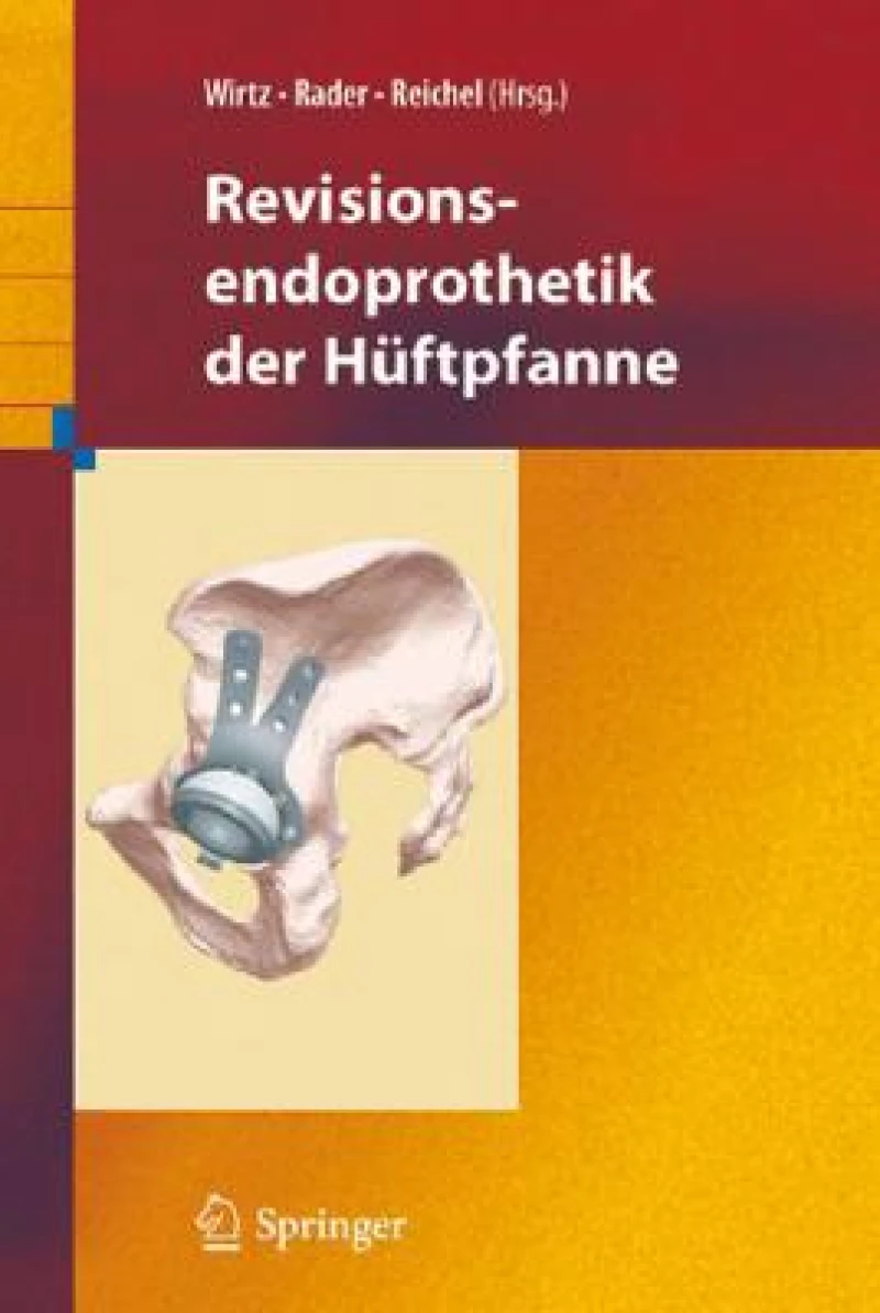 Revisionsendoprothetik der Huftpfanne