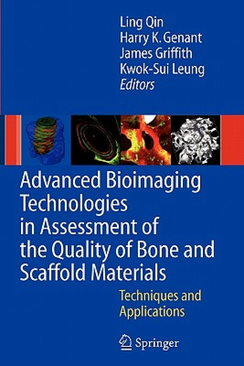 Advanced Bioimaging Technologies in Assessment of the Quality of Bone and Scaffold Materials