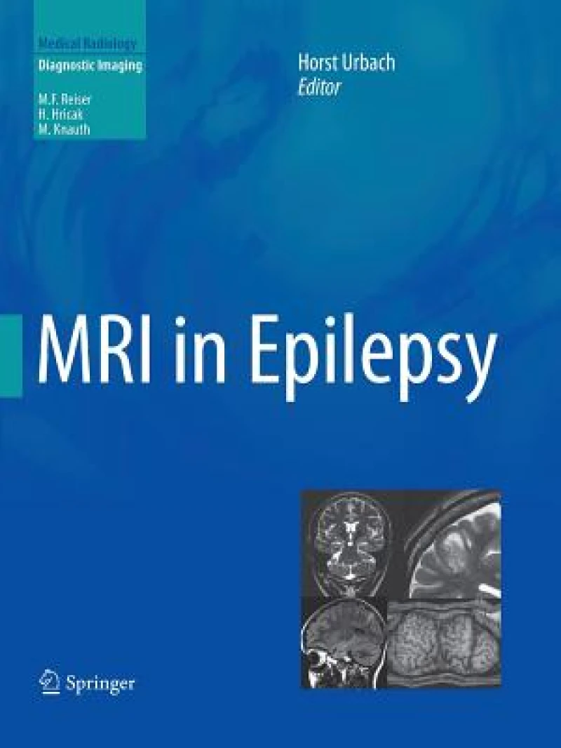 MRI in Epilepsy