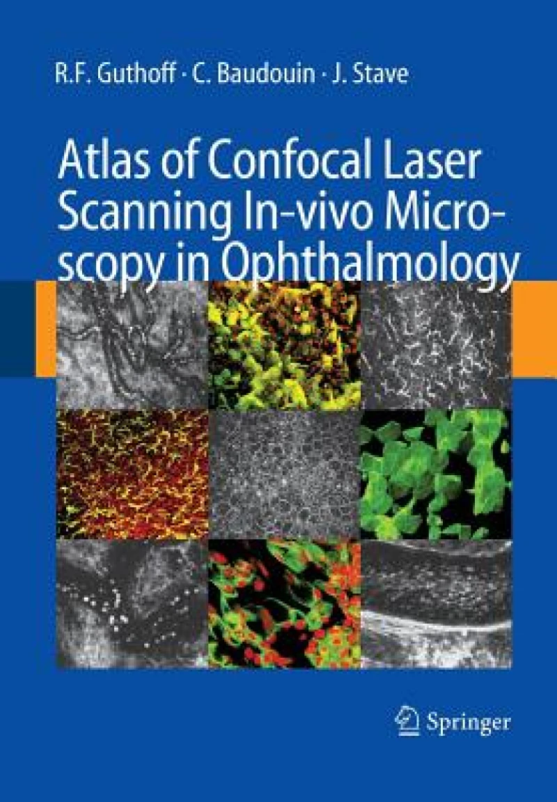 Atlas of Confocal Laser Scanning In-vivo Microscopy in Ophthalmology