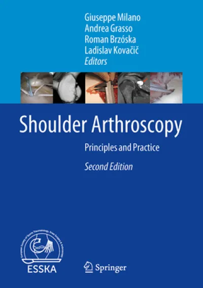 Shoulder Arthroscopy