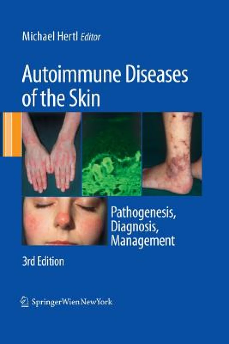Autoimmune Diseases of the Skin