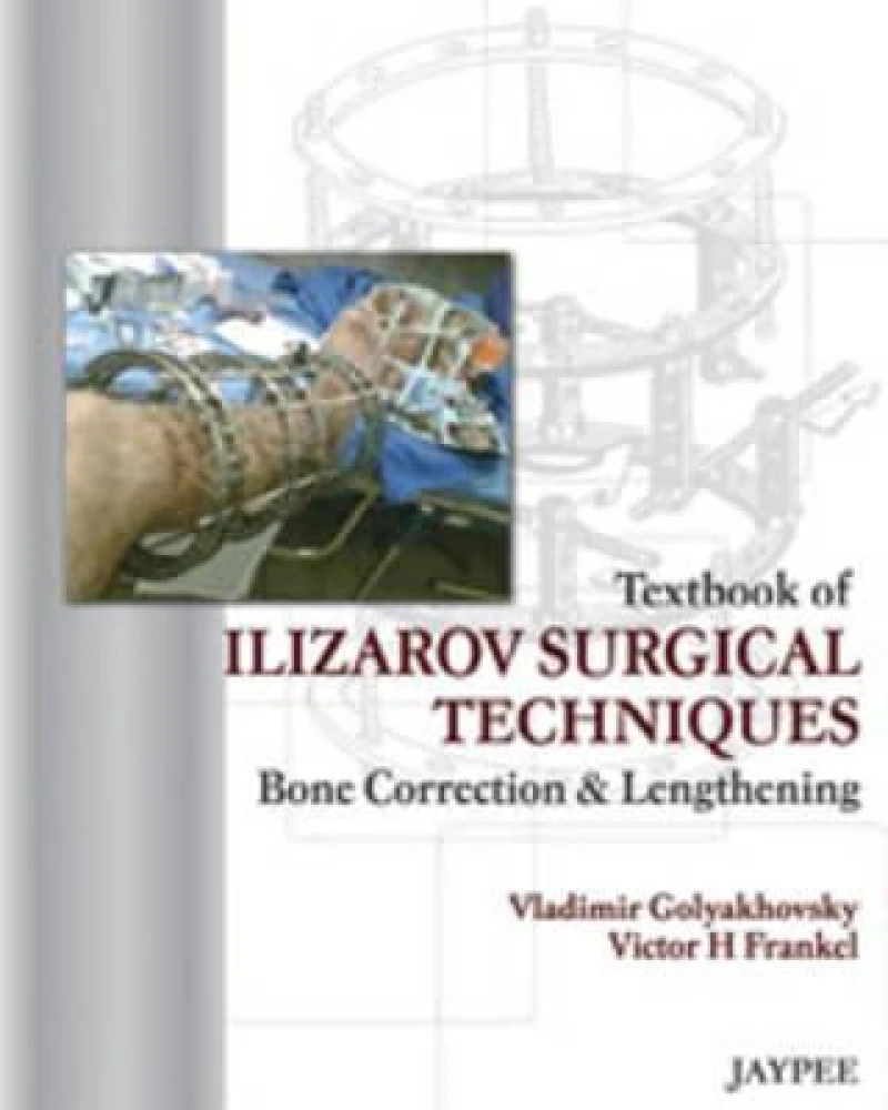 Textbook of Ilizarov Surgical Techniques