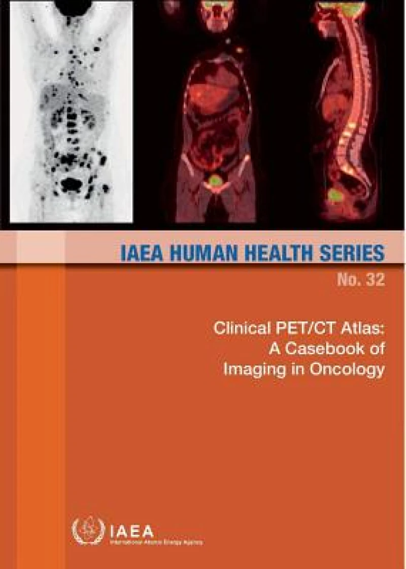 Clinical PET/CT Atlas