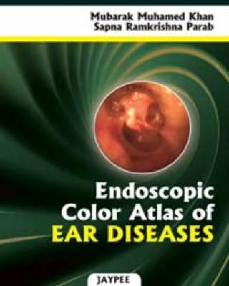 Endoscopic Color Atlas of Ear Diseases