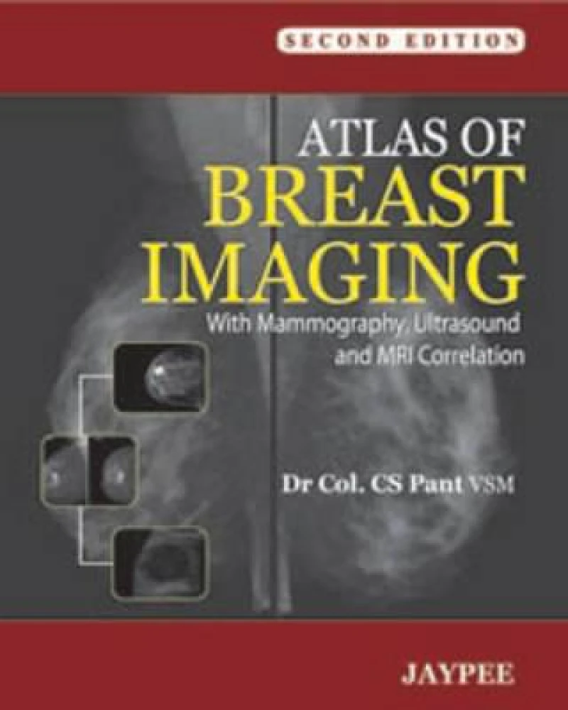 Atlas of Breast Imaging