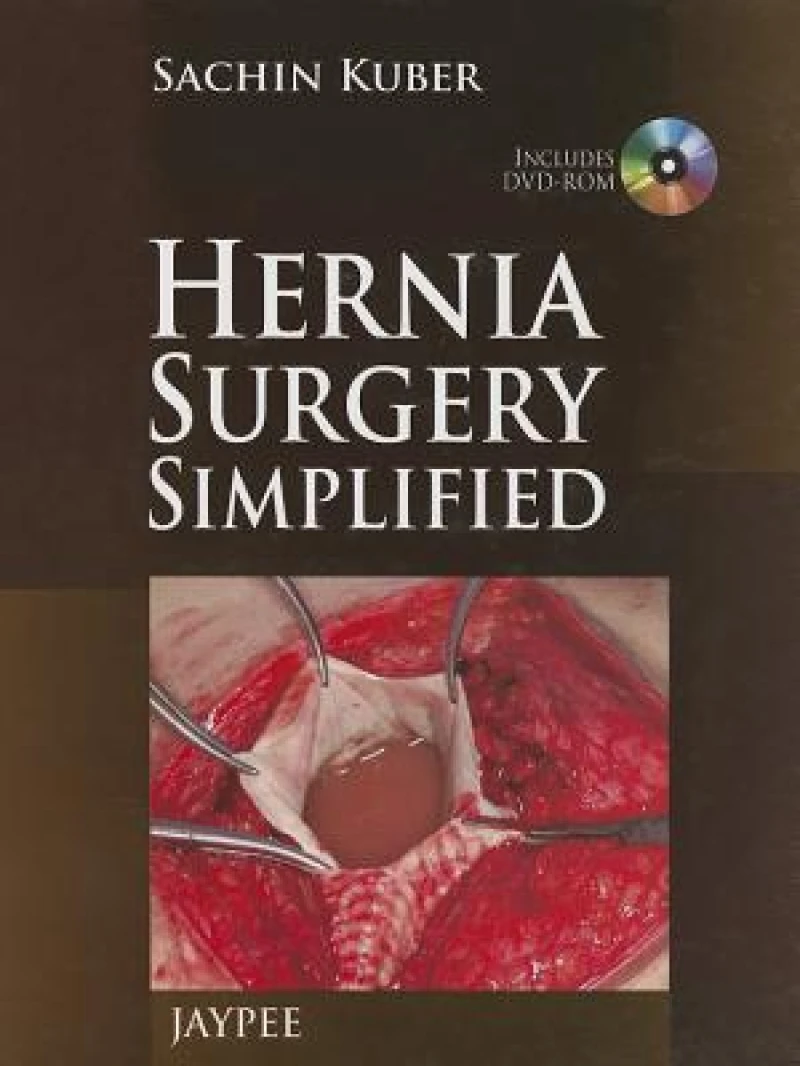 Hernia Surgery Simplified
