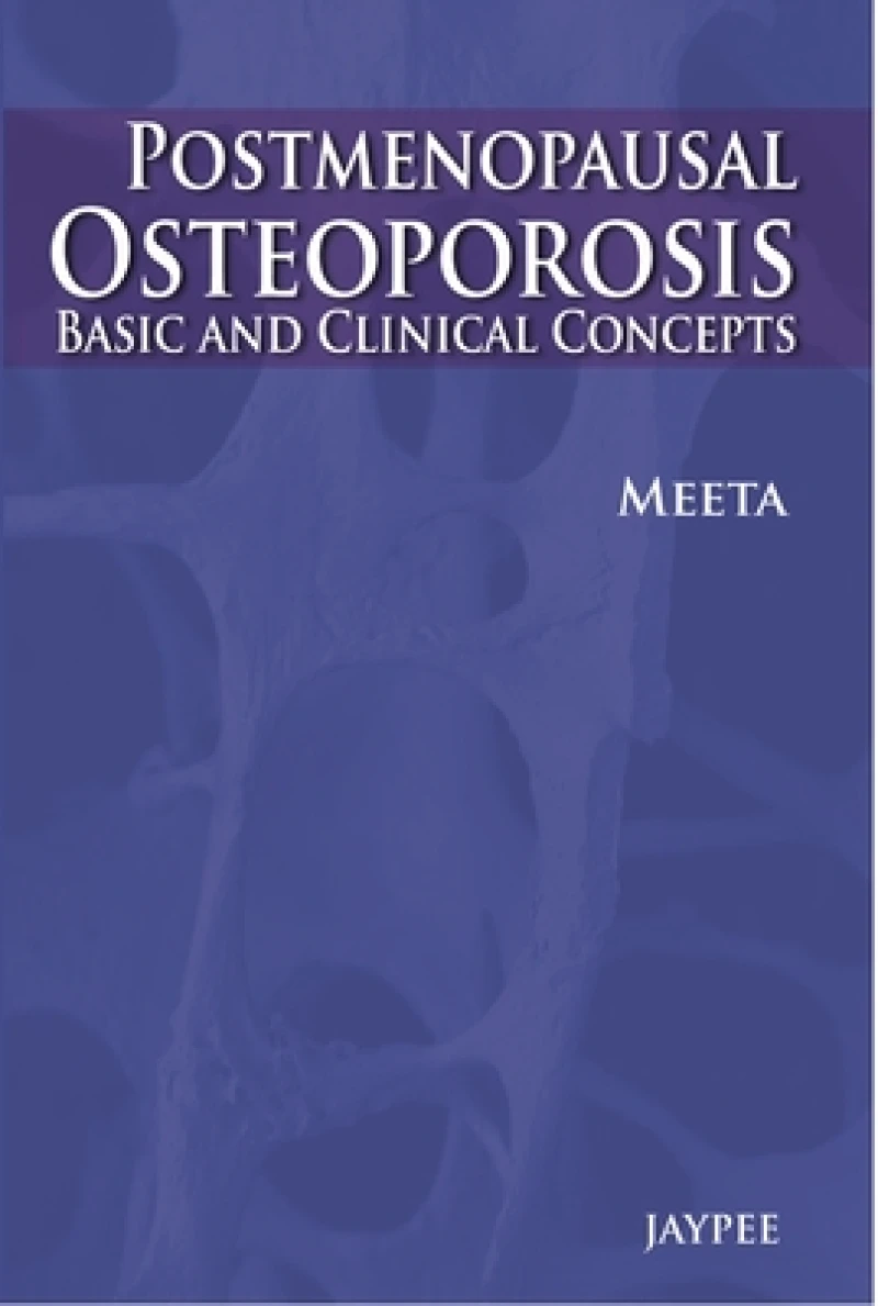 Post-Menopausal Osteoporosis