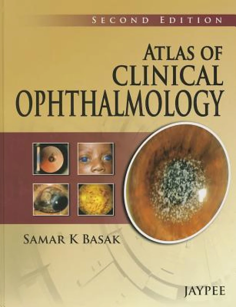 Atlas of Clinical Ophthalmology