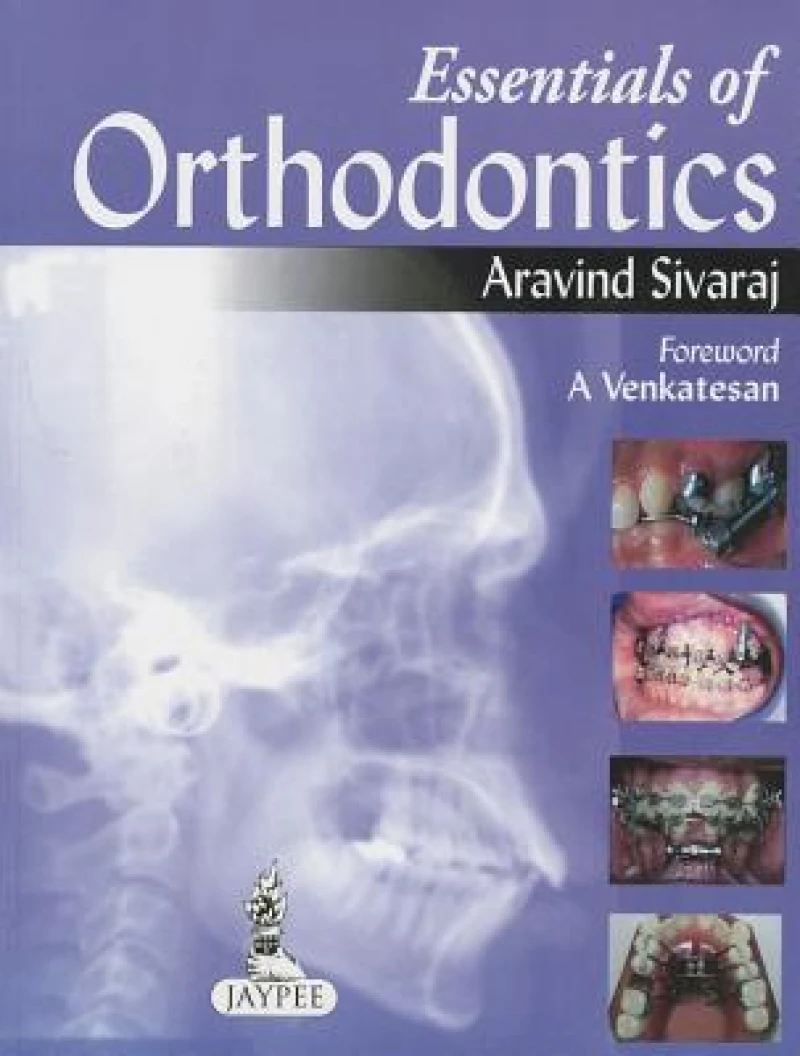 Essentials of Orthodontics