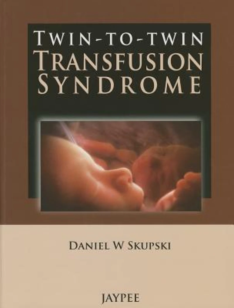 Twin-to-Twin Transfusion Syndrome