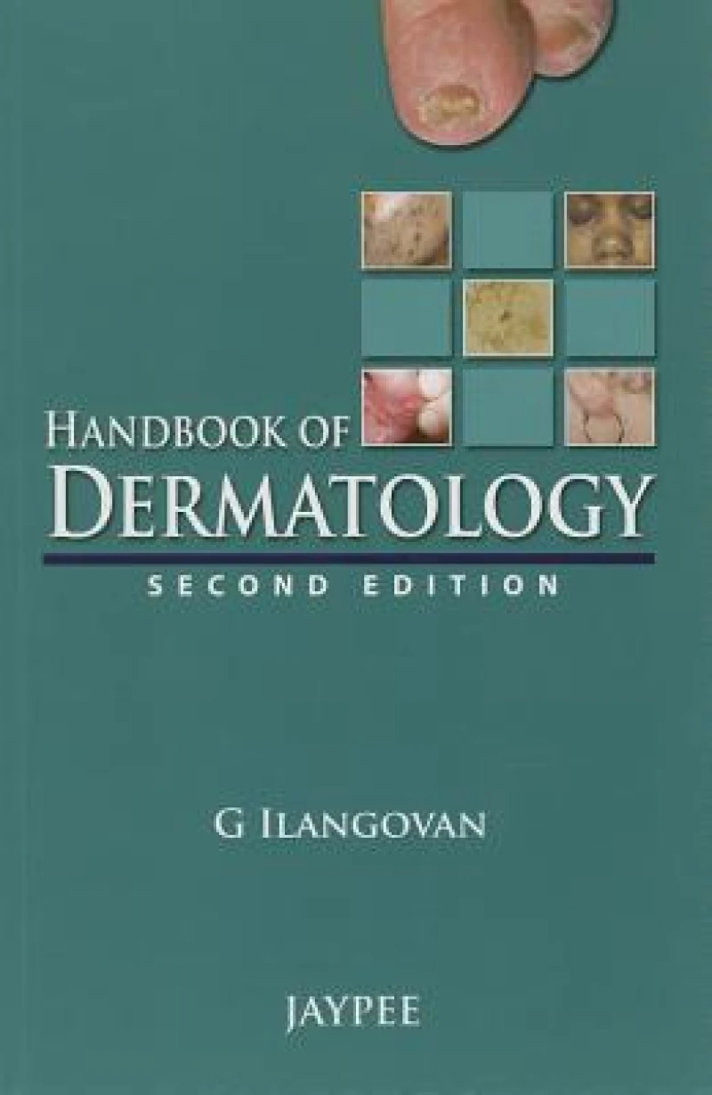 Handbook of Dermatology