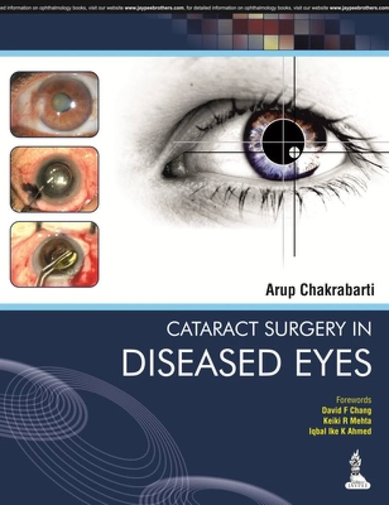 Cataract Surgery in Diseased Eyes