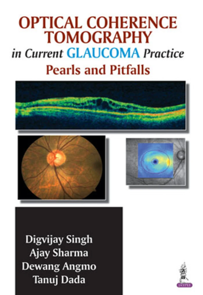 Optical Coherence Tomography in Current Glaucoma Practice