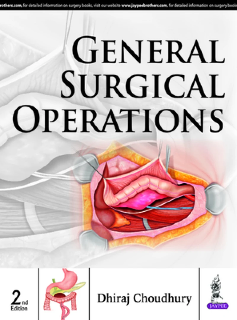 General Surgical Operations