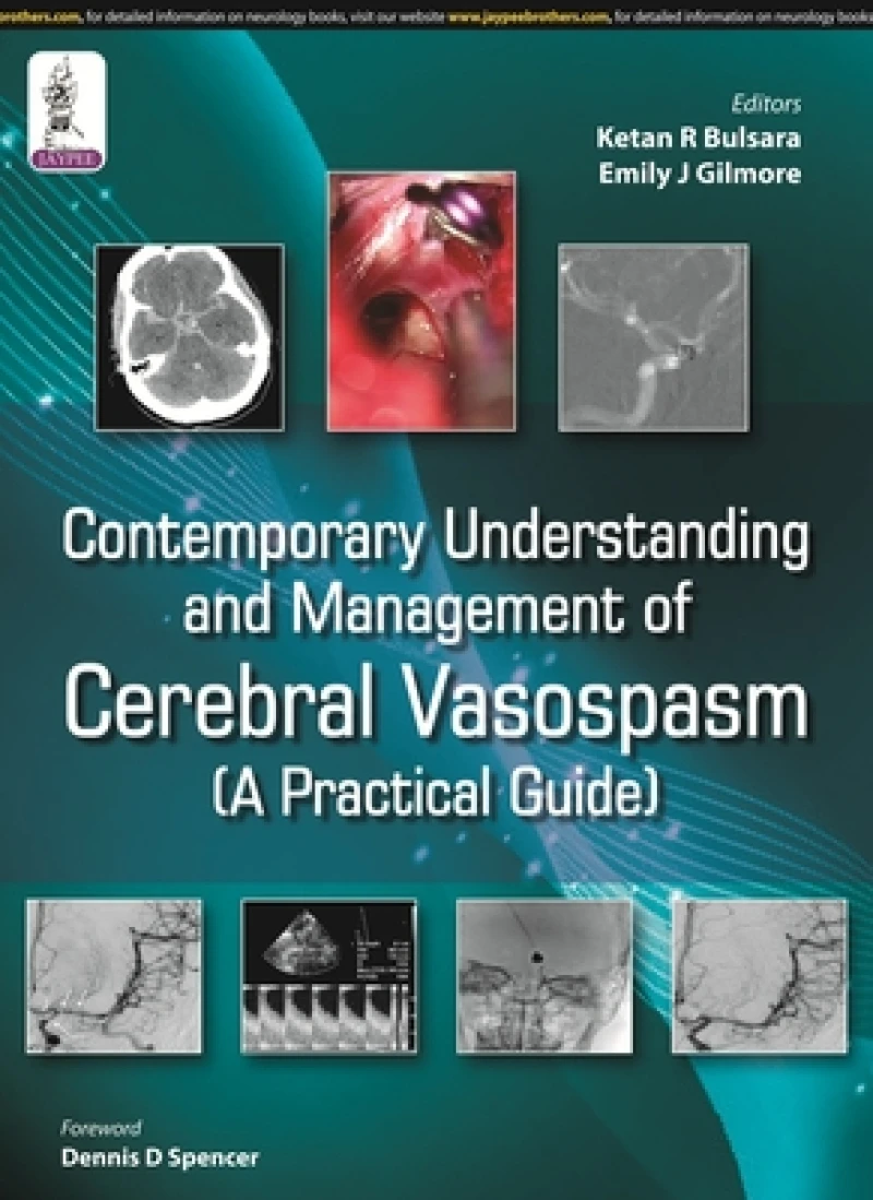 Contemporary Understanding and Management of Cerebral Vasospasm
