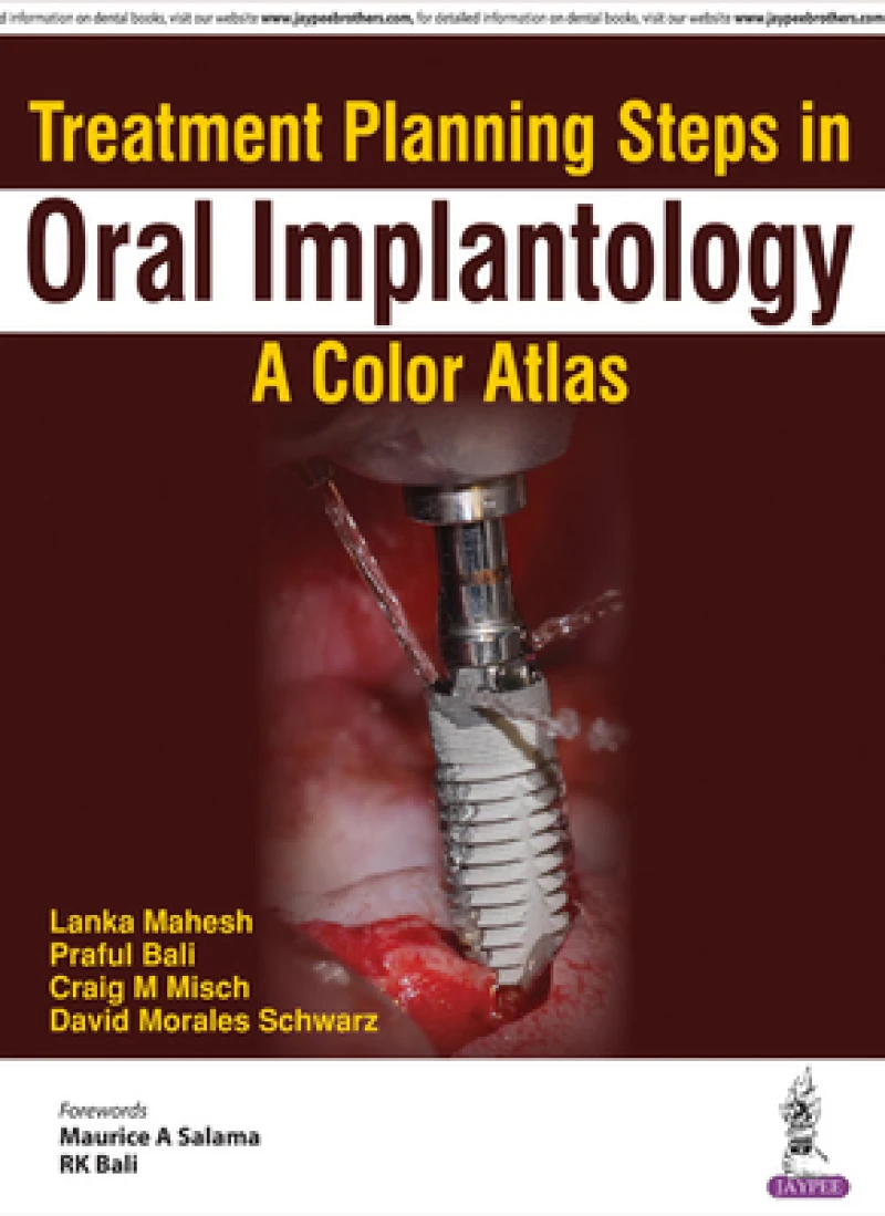 Treatment Planning Steps in Oral Implantology