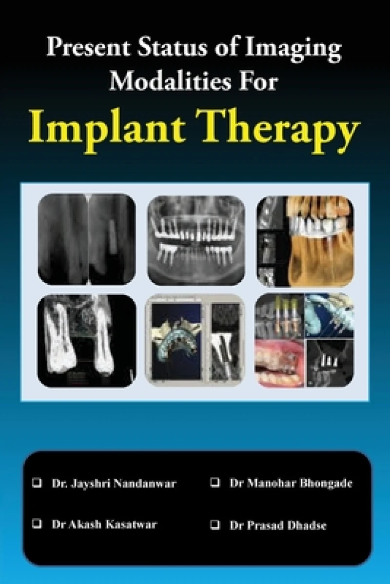 Present Status of Imaging Modalities for Implant Therapy